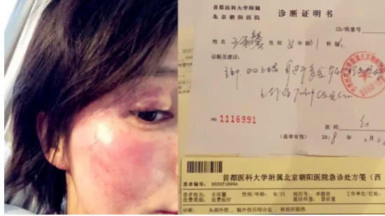 王雨馨发文道歉：与黄景瑜两年前离婚，没有孩子，对自杀行为非常后悔