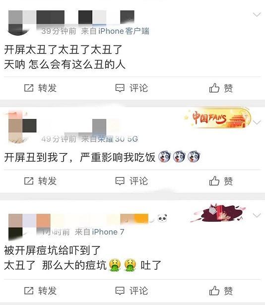 易烊千玺频签国际代言，拍摄广告大片不遮瑕，脸上痘坑遭黑粉嫌丑