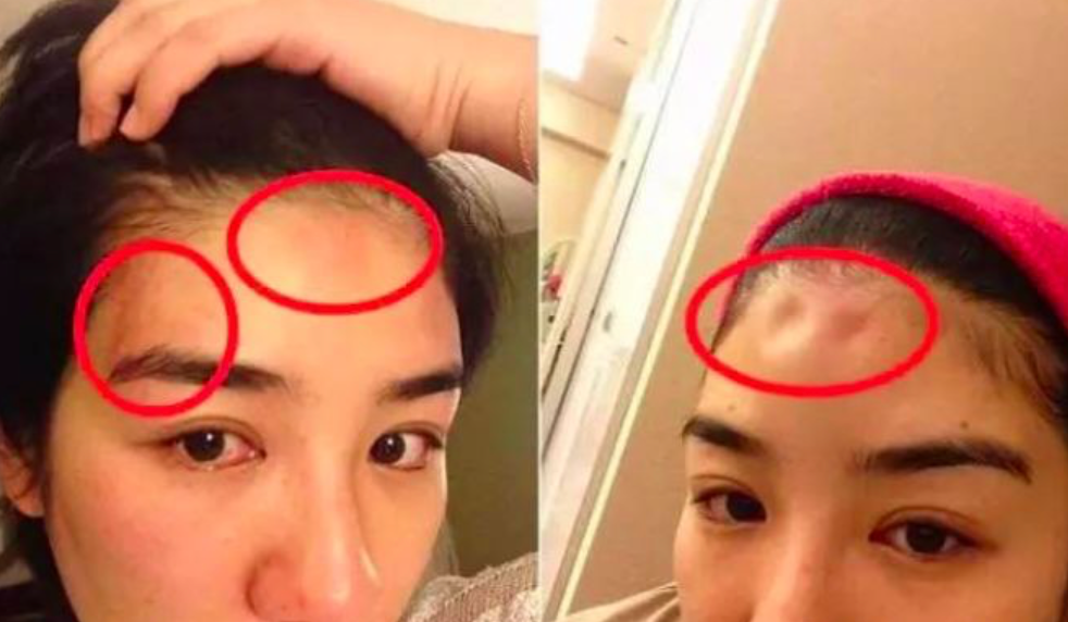 这次，黄奕终于解脱了……